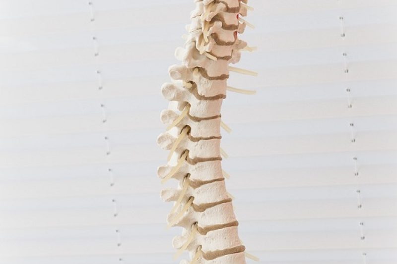 What is a Spinal Subluxation